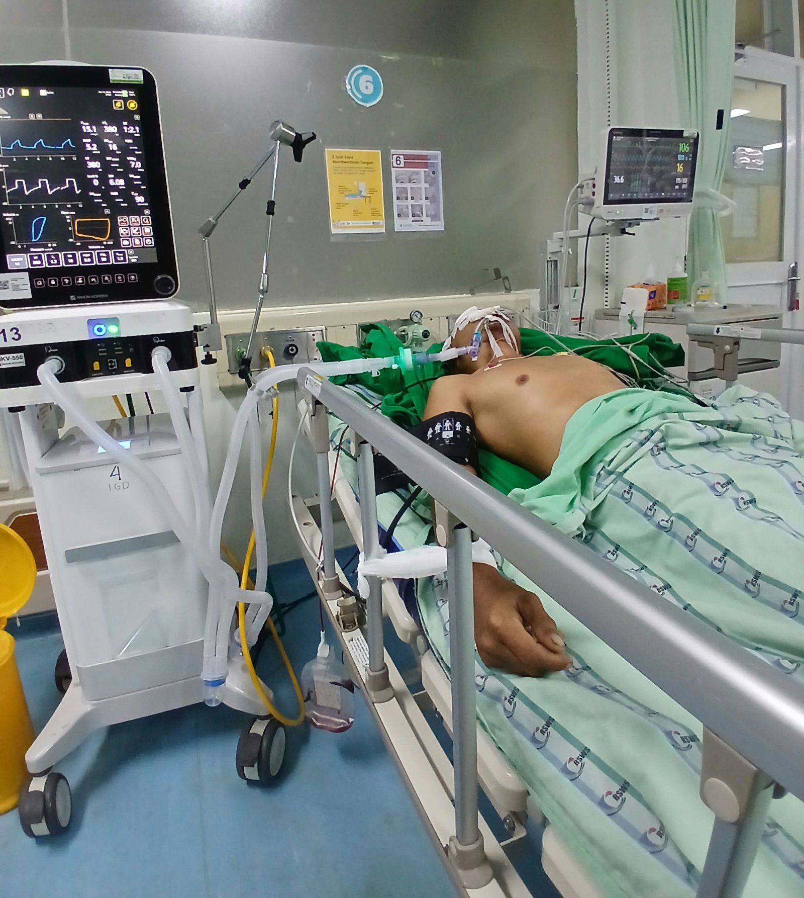 Sudah 5 Hari Koma di ICU RS Wahidin, Korban Tabrak Lari di Somba Opu Belum Sadarkan Diri
